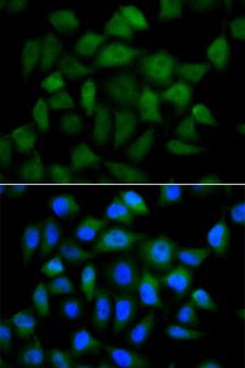 Alpha-Fetoprotein Antibody - Immunofluorescence analysis of HeLa cells using AFP antibody. Blue: DAPI for nuclear staining.