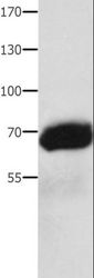 Alpha-Fetoprotein Antibody - Western blot analysis of Human liver cancer tissue, using AFP Polyclonal Antibody at dilution of 1:1000.