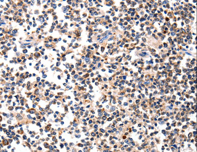 Alpha-Fetoprotein Antibody - Immunohistochemistry of paraffin-embedded Human tonsil using AFP Polyclonal Antibody at dilution of 1:60.