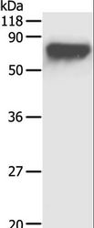 Alpha-Fetoprotein Antibody - Western blot analysis of HepG2 cell, using AFP Polyclonal Antibody at dilution of 1:1000.