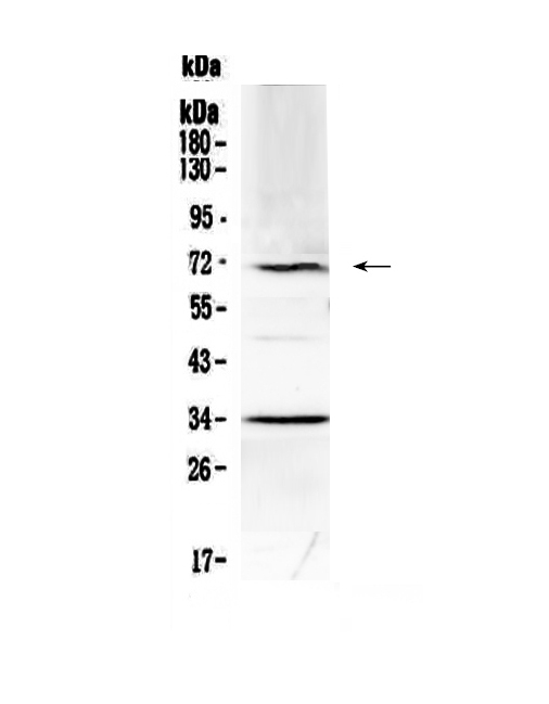 Alpha-Fetoprotein Antibody - Western blot - Anti-Alpha 1 Fetoprotein Picoband antibody