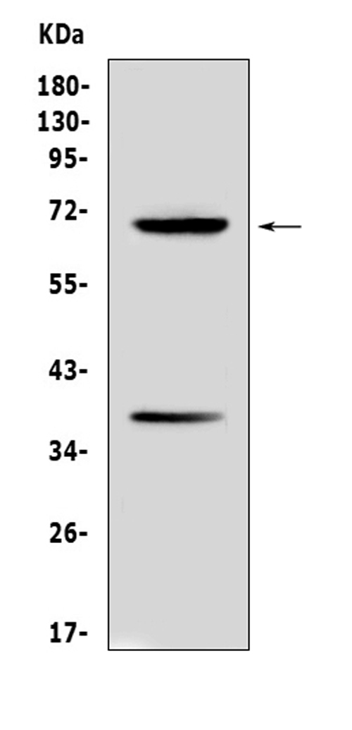 Alpha-Fetoprotein Antibody - Western blot analysis of Alpha 1 Fetoprotein using anti-Alpha 1 Fetoprotein antibody. Electrophoresis was performed on a 5-20% SDS-PAGE gel at 70V (Stacking gel) / 90V (Resolving gel) for 2-3 hours. The sample well of each lane was loaded with 50ug of sample under reducing conditions. Lane 1: mouse HEPA1-6 cell lysates. After Electrophoresis, proteins were transferred to a Nitrocellulose membrane at 150mA for 50-90 minutes. Blocked the membrane with 5% Non-fat Milk/ TBS for 1.5 hour at RT. The membrane was incubated with rabbit anti-Alpha 1 Fetoprotein antigen affinity purified polyclonal antibody at 0.5 µg/mL overnight at 4°C, then washed with TBS-0.1% Tween 3 times with 5 minutes each and probed with a goat anti-rabbit IgG-HRP secondary antibody at a dilution of 1:10000 for 1.5 hour at RT. The signal is developed using an Enhanced Chemiluminescent detection (ECL) kit with Tanon 5200 system. A specific band was detected for Alpha 1 Fetoprotein at approximately 69KD. The expected band size for Alpha 1 Fetoprotein is at 69KD.