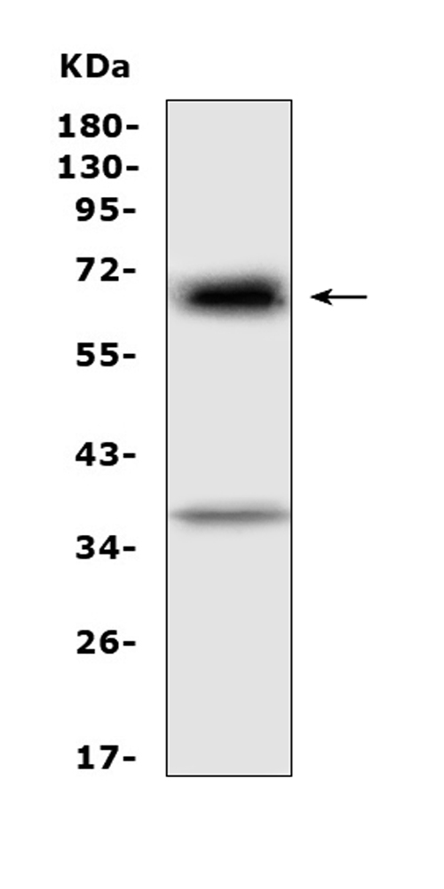 Alpha-Fetoprotein Antibody - Western blot analysis of Alpha 1 Fetoprotein using anti-Alpha 1 Fetoprotein antibody. Electrophoresis was performed on a 5-20% SDS-PAGE gel at 70V (Stacking gel) / 90V (Resolving gel) for 2-3 hours. The sample well of each lane was loaded with 50ug of sample under reducing conditions. Lane 1: rat RH35 whole cell lysates. After Electrophoresis, proteins were transferred to a Nitrocellulose membrane at 150mA for 50-90 minutes. Blocked the membrane with 5% Non-fat Milk/ TBS for 1.5 hour at RT. The membrane was incubated with rabbit anti-Alpha 1 Fetoprotein antigen affinity purified polyclonal antibody at 0.5 µg/mL overnight at 4°C, then washed with TBS-0.1% Tween 3 times with 5 minutes each and probed with a goat anti-rabbit IgG-HRP secondary antibody at a dilution of 1:10000 for 1.5 hour at RT. The signal is developed using an Enhanced Chemiluminescent detection (ECL) kit with Tanon 5200 system. A specific band was detected for Alpha 1 Fetoprotein at approximately 69KD. The expected band size for Alpha 1 Fetoprotein is at 69KD.