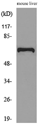 Alpha-Fetoprotein Antibody - Western blot analysis of lysate from mouse liver cells, using AFP Antibody.