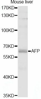 Alpha-Fetoprotein Antibody - Western blot analysis of extracts of mouse liver, using AFP antibody at 1:1000 dilution. The secondary antibody used was an HRP Goat Anti-Rabbit IgG (H+L) at 1:10000 dilution. Lysates were loaded 25ug per lane and 3% nonfat dry milk in TBST was used for blocking. An ECL Kit was used for detection and the exposure time was 60s.