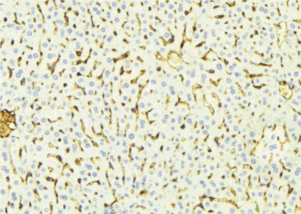 Alpha-Fetoprotein Antibody - 1:100 staining mouse liver tissue by IHC-P. The sample was formaldehyde fixed and a heat mediated antigen retrieval step in citrate buffer was performed. The sample was then blocked and incubated with the antibody for 1.5 hours at 22°C. An HRP conjugated goat anti-rabbit antibody was used as the secondary.