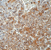 Alpha-Fetoprotein Antibody - Formalin-fixed, paraffin-embedded human fetal liver stained with peroxidase-conjugate and DAB chromogen. Note cytoplasmic staining of fetal hepatocytes.