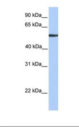 Alpha Fucosidase / FUCA1 Antibody - Fetal liver lysate. Antibody concentration: 1.0 ug/ml. Gel concentration: 12%.  This image was taken for the unconjugated form of this product. Other forms have not been tested.