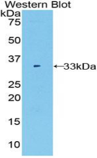 Alpha Fucosidase / FUCA1 Antibody - Western blot of recombinant Alpha Fucosidase / FUCA1.  This image was taken for the unconjugated form of this product. Other forms have not been tested.