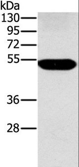 Alpha Fucosidase / FUCA1 Antibody - Western blot analysis of Human placenta tissue, using FUCA1 Polyclonal Antibody at dilution of 1:500.