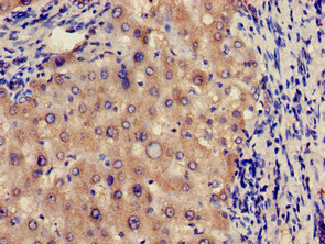 Alpha Fucosidase / FUCA1 Antibody - Immunohistochemistry of paraffin-embedded human liver tissue at dilution of 1:100