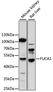 Alpha Fucosidase / FUCA1 Antibody - Western blot analysis of extracts of various cell lines, using FUCA1 antibody at 1:1000 dilution. The secondary antibody used was an HRP Goat Anti-Rabbit IgG (H+L) at 1:10000 dilution. Lysates were loaded 25ug per lane and 3% nonfat dry milk in TBST was used for blocking. An ECL Kit was used for detection and the exposure time was 30s.