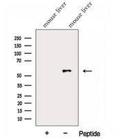 Alpha Fucosidase / FUCA1 Antibody - Western blot analysis of extracts of mouse liver tissue using FUCA1 antibody. The lane on the left was treated with blocking peptide.