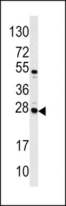Alpha-S1-Casein / CSN1S1 Antibody - Western blot of CASA antibody in Jurkat cell line lysates (35 ug/lane). CASA (arrow) was detected using the purified antibody.