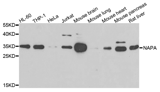 Alpha SNAP Antibody - Western blot analysis of extracts of various cells.
