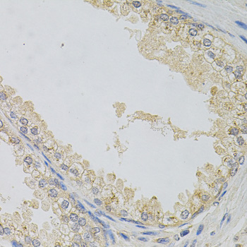 Alpha SNAP Antibody - Immunohistochemistry of paraffin-embedded human prostate.