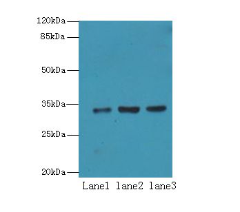 Alpha SNAP Antibody - Western blot. All lanes: NAPA antibody at 7 ug/ml. Lane 1: 293T whole cell lysate. Lane 2: HeLa whole cell lysate. Lane 3: K562 whole cell lysate. Secondary antibody: Goat polyclonal to Rabbit IgG at 1:10000 dilution. Predicted band size: 33 kDa. Observed band size: 33 kDa.