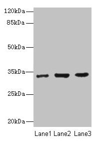Alpha SNAP Antibody - Western blot All lanes: NAPA antibody at 7µg/ml Lane 1: 293T whole cell lysate Lane 2: Hela whole cell lysate Lane 3: K562 whole cell lysate Secondary Goat polyclonal to rabbit IgG at 1/10000 dilution Predicted band size: 33 kDa Observed band size: 33 kDa