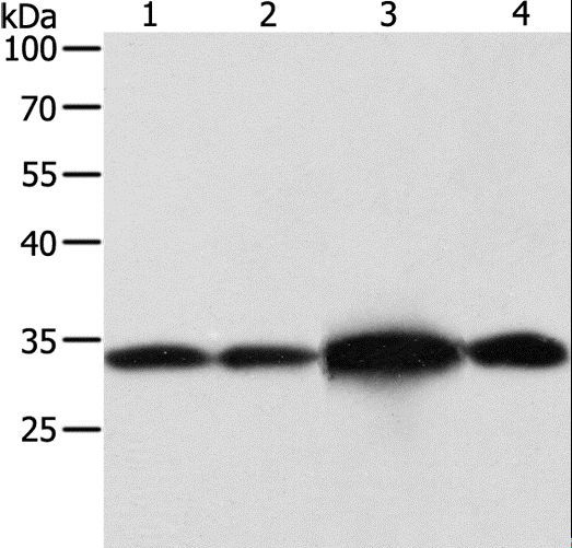 Alpha SNAP Antibody - Western blot analysis of HeLa and Jurkat cell, mouse brain tissue and 293T cell, using NAPA Polyclonal Antibody at dilution of 1:500.