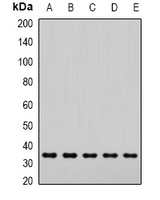 Alpha SNAP Antibody - Western blot analysis of SNAP-alpha expression in HeLa (A); Jurkat (B); mouse brain (C); mouse lung (D); rat liver (E) whole cell lysates.