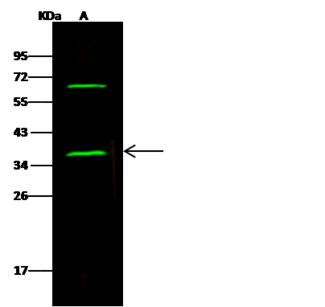 Alpha SNAP Antibody - Anti-NAPA rabbit polyclonal antibody at 1:500 dilution. Lane A: Jurkat Whole Cell Lysate. Lysates/proteins at 30 ug per lane. Secondary: Goat Anti-Rabbit IgG H&L (Dylight 800) at 1/10000 dilution. Developed using the Odyssey technique. Performed under reducing conditions. Predicted band size: 33 kDa. Observed band size: 36 kDa. (We are unsure as to the identity of these extra bands.)