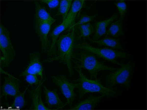 Alpha Tubulin Antibody - Immunofluorescence microscopy of rabbit Anti-alpha-Tubulin antibody using HeLa cells fixed with PFA. Anti-alpha-Tubulin Antibody was used at 1 µg/mL, O/N at 4°C. Secondary antibody: Anti-RABBIT IgG DyLight 488 Conjugated Preadsorbed at 2 ug/ml for 1 h at RT. Localization: TUBA1B is the major constituent of microtubules in the cytoplasm. Staining: Tubulin as green fluorescent signal with DAPI (blue) nuclear counterstain.