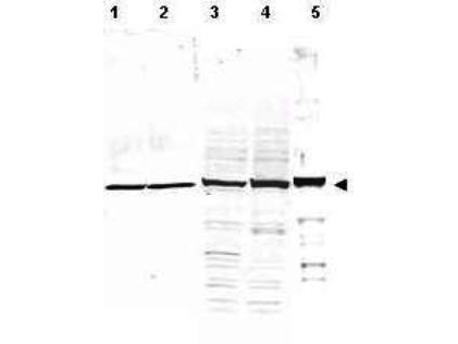 Alpha Tubulin Antibody - Western Blot of rabbit Anti-Alpha Tubulin Antibody. Lane 1: whole cell lysates from mouse brain. Lane 2: rat brain. Lane 3: A431 cells. Lane 4: Jurkat cells. Lane 5: HeLa cells. Load: 35 µg per lane. Primary antibody: Alpha Tubulin antibody at 1:1,200 for overnight at 4°C. Secondary antibody: rabbit secondary antibody at 1:10,000 for 45 min at RT. Block: 5% BLOTTO overnight at 4°C. Predicted/Observed size: ~50 kDa corresponding to alpha tubulin (arrowhead). Other band(s): none.