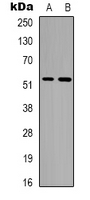 Alpha Tubulin Antibody - Western blot analysis of Alpha-tubulin (AcK352) expression in A549 (A); Jurkat (B) whole cell lysates.