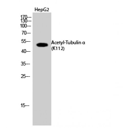 Alpha Tubulin Antibody - Western blot of Acetyl-Tubulin alpha (K112) antibody