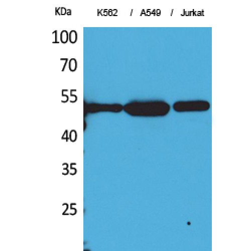 Alpha Tubulin Antibody - Western blot of Acetyl-Tubulin alpha (K352) antibody