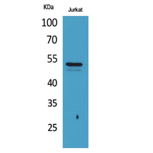 Alpha Tubulin Antibody - Western blot of Acetyl-Tubulin alpha (K40) antibody
