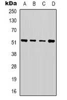 Alpha Tubulin Antibody - Western blot analysis of Alpha-tubulin expression in HeLa (A); A549 (B); MCF7 (C); NIH3T3 (D) whole cell lysates.