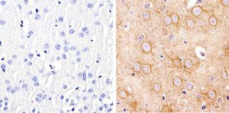 Alpha Tubulin Antibody - Immunohistochemistry analysis of Alpha-Tubulin showing staining in the cytoplasm of paraffin-embedded mouse brain tissue (right) compared to a negative control without primary antibody (left). To expose target proteins, antigen retrieval was performed using 10mM sodium citrate (pH 6.0), microwaved for 8-15 min. Following antigen retrieval, tissues were blocked in 3% H2O2-methanol for 15 min at room temperature, washed with ddH2O and PBS, and then probed with a Alpha-Tubulin diluted in 3% BSA-PBS at a dilution of 1:20 overnight at 4°C in a humidified chamber. Tissues were washed extensively in PBST and detection was performed using an HRP-conjugated secondary antibody followed by colorimetric detection using a DAB kit. Tissues were counterstained with hematoxylin and dehydrated with ethanol and xylene to prep for mounting.
