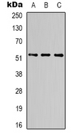 Alpha Tubulin Antibody - Western blot analysis of Alpha-tubulin expression in HeLa (A); mouse brain (B); rat brain (C) whole cell lysates.