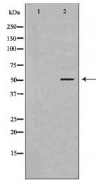 Alpha Tubulin Antibody - Western blot of extracts of Jurkat cell lines, using CFLAR antibody.