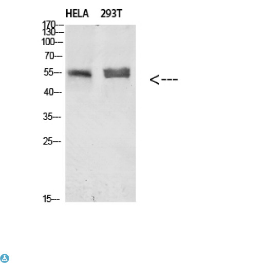 Alpha Tubulin Antibody - Western blot analysis of HELA and 293T Cell Lysate. Secondary antibody was diluted at 1:20000.