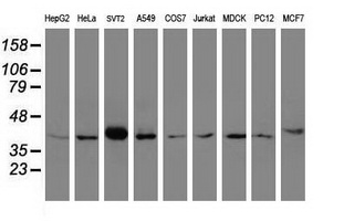 Alpha4GnT / A4GNT Antibody - Western blot of extracts (35ug) from 9 different cell lines by using anti-A4GNT monoclonal antibody (HepG2: human; HeLa: human; SVT2: mouse; A549: human; COS7: monkey; Jurkat: human; MDCK: canine; PC12: rat; MCF7: human).