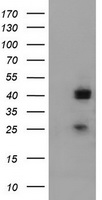 Alpha4GnT / A4GNT Antibody - HEK293T cells were transfected with the pCMV6-ENTRY control (Left lane) or pCMV6-ENTRY A4GNT (Right lane) cDNA for 48 hrs and lysed. Equivalent amounts of cell lysates (5 ug per lane) were separated by SDS-PAGE and immunoblotted with anti-A4GNT.