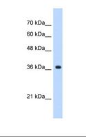 Alpha4GnT / A4GNT Antibody - HepG2 cell lysate. Antibody concentration: 0.25 ug/ml. Gel concentration: 12%.  This image was taken for the unconjugated form of this product. Other forms have not been tested.
