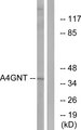 Alpha4GnT / A4GNT Antibody - Western blot analysis of lysates from K562 cells, using A4GNT Antibody. The lane on the right is blocked with the synthesized peptide.