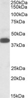 Alpha4GnT / A4GNT Antibody - A4GNT antibody (1 ug/ml) staining of K562 lysate (35 ug protein in RIPA buffer). Primary incubation was 1 hour. Detected by chemiluminescence.
