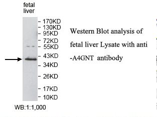Alpha4GnT / A4GNT Antibody