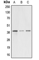 Alpha4GnT / A4GNT Antibody - Western blot analysis of A4GNT expression in HEK293T (A); mouse testis (B); rat kidney (C) whole cell lysates.