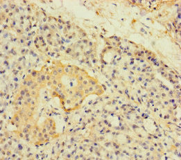 Alpha4GnT / A4GNT Antibody - Immunohistochemistry of paraffin-embedded human pancreatic tissue using A4GNT Antibody at dilution of 1:100