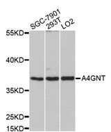 Alpha4GnT / A4GNT Antibody - Western blot analysis of extracts of various cell lines, using A4GNT antibody at 1:1000 dilution. The secondary antibody used was an HRP Goat Anti-Rabbit IgG (H+L) at 1:10000 dilution. Lysates were loaded 25ug per lane and 3% nonfat dry milk in TBST was used for blocking. An ECL Kit was used for detection and the exposure time was 90s.