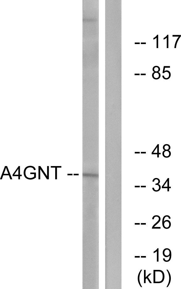 Alpha4GnT / A4GNT Antibody - Western blot analysis of extracts from K562 cells, using A4GNT antibody.