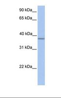 Alpha4GnT / A4GNT Antibody - Fetal muscle lysate. Antibody concentration: 1.0 ug/ml. Gel concentration: 12%.  This image was taken for the unconjugated form of this product. Other forms have not been tested.