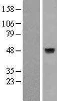 Alpha4GnT / A4GNT Protein - Western validation with an anti-DDK antibody * L: Control HEK293 lysate R: Over-expression lysate