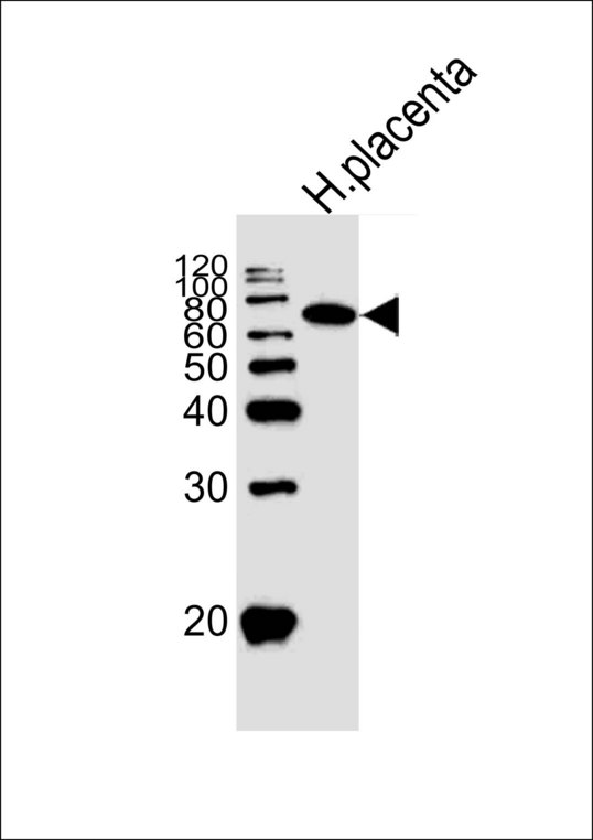 ALPI / Alkaline Phosphatase Antibody - Western blot of lysate from human placenta tissue lysate, using ALPI Antibody. Antibody was diluted at 1:1000. A goat anti-rabbit IgG H&L (HRP) at 1:10000 dilution was used as the secondary antibody. Lysate at 20ug.