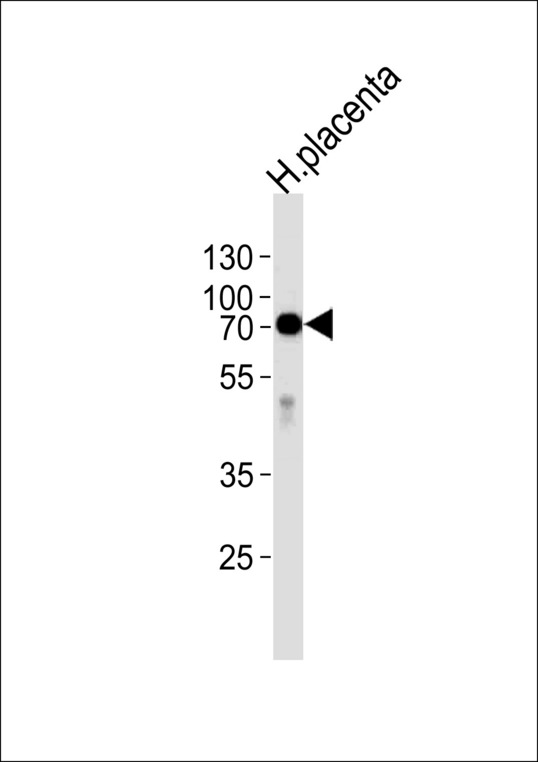 ALPI / Alkaline Phosphatase Antibody - Western blot of lysate from human placenta tissue,using ALPI Antibody. Antibody was diluted at 1:1000 at each lane. A goat anti-rabbit IgG H&L (HRP) at 1:5000 dilution was used as the secondary antibody.Lysate at 35ug per lane.
